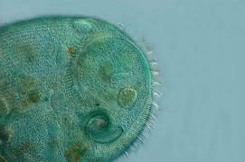 cilié (Stentor caeruleus ) / © R. Wagner, W. Bettigofer, J.-M. Babalian, P. Galliker et R. Birke/P. ArnolD (biosphoto)