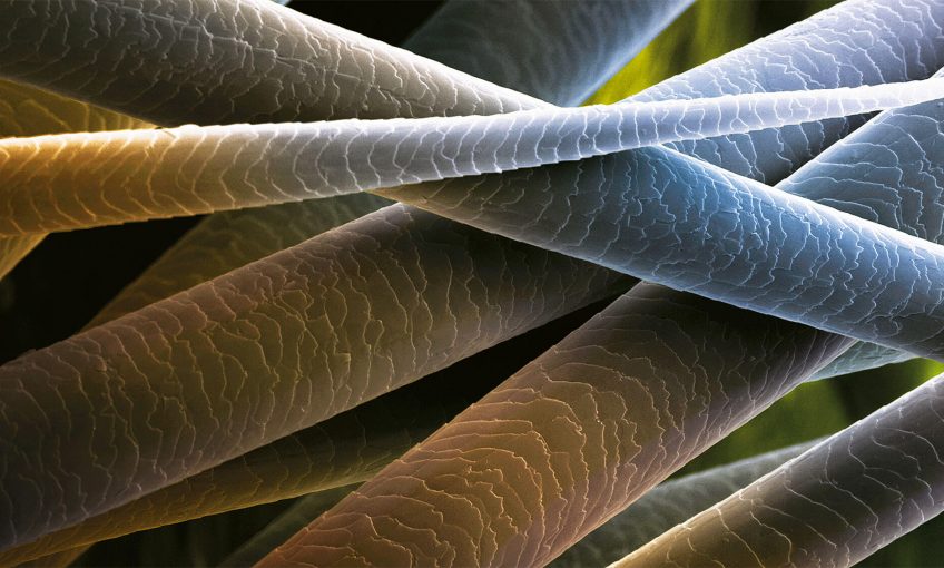 le poil se retrouve aussi bien chez les animaux que chez les plantes