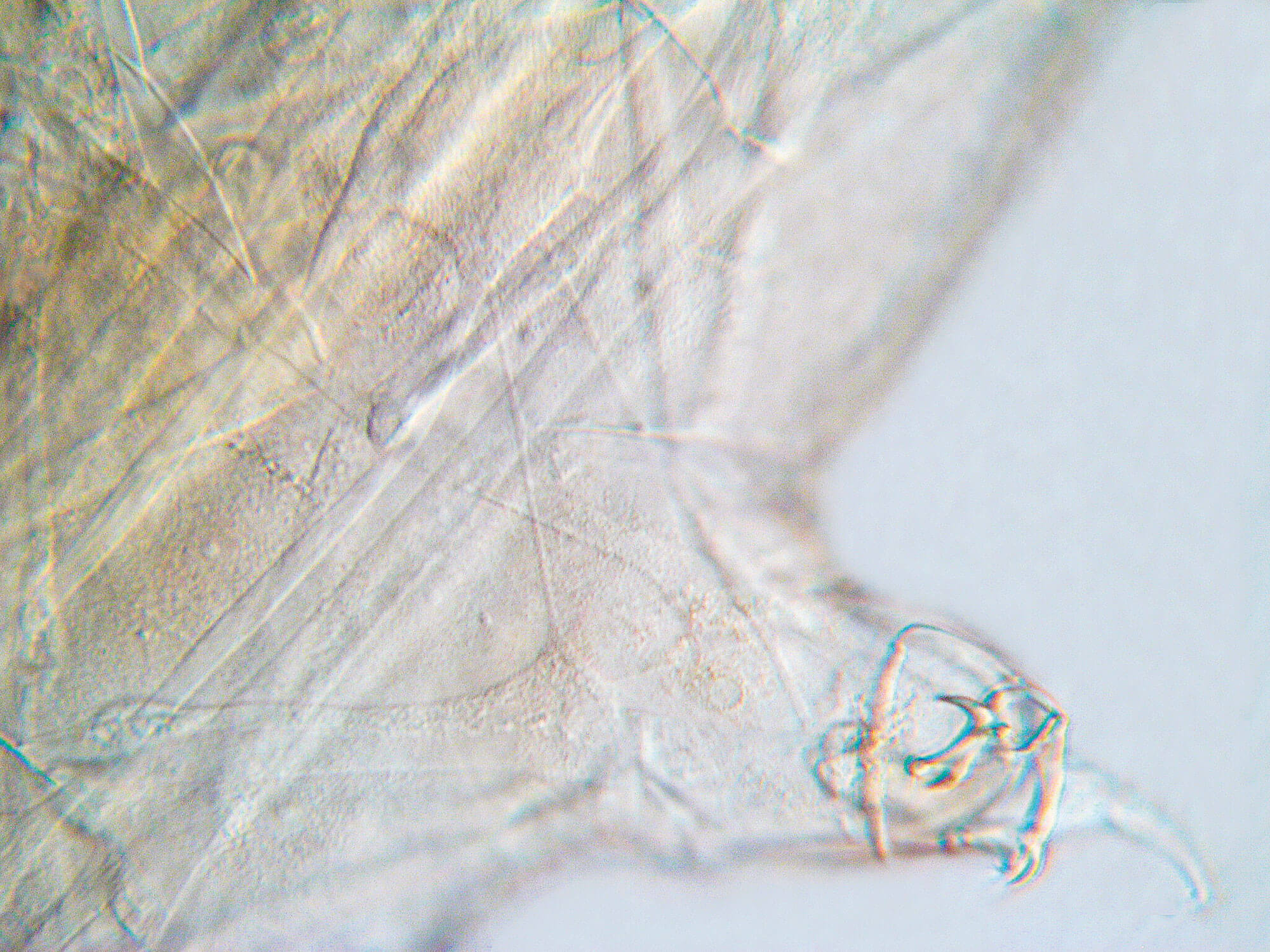 Le tardigrade, p'tit bonhomme à huit pattes