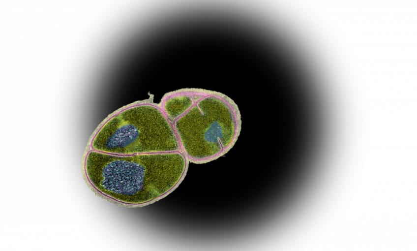 Deinococcus radiodurans, la bactérie qui ressuscite